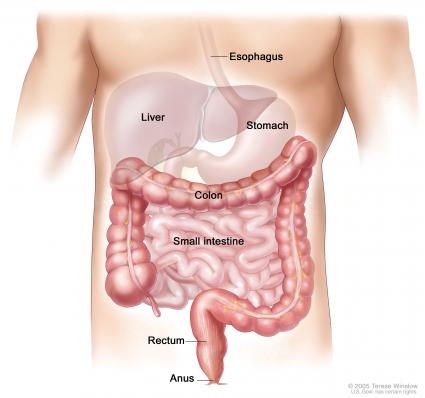 colon cancer, colon cancer surgery, colon cancer treatment