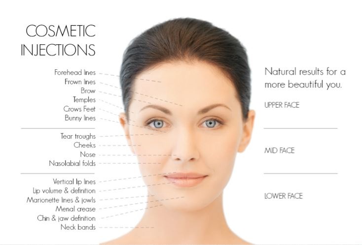 Cosmetic Injectables, fillers