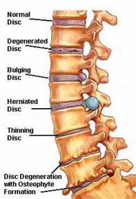 spine-surgery